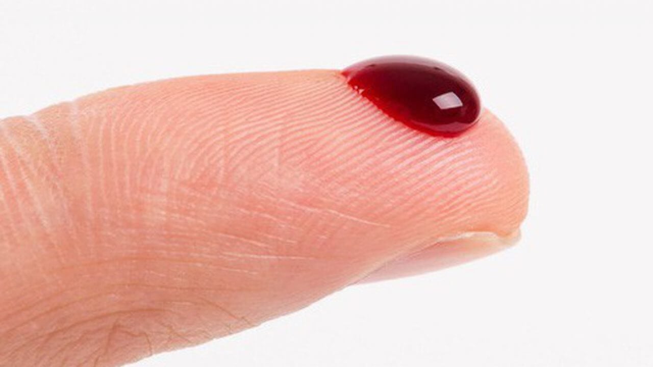Giới thiệu chung về giấc mơ thấy máu