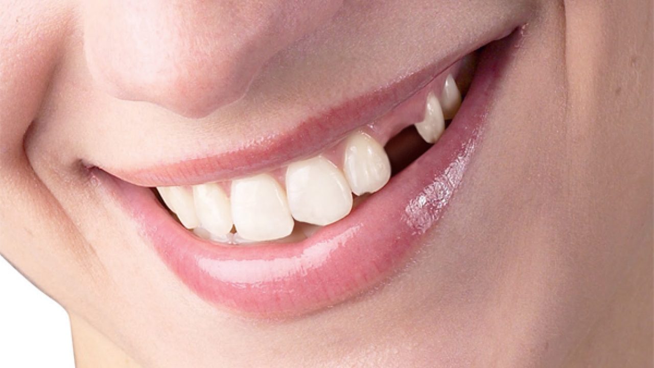 Vì sao nằm mơ thấy rụng răng lại thường được dùng để tìm số?